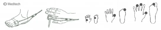 Meditech SpO2 sensor (Wrap Oxymètre de pouls sensor)
