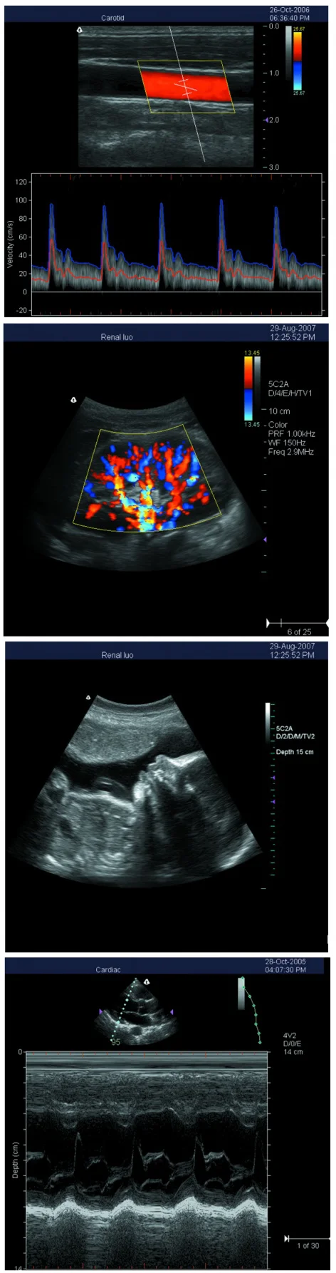S5i ultrasound Scanner