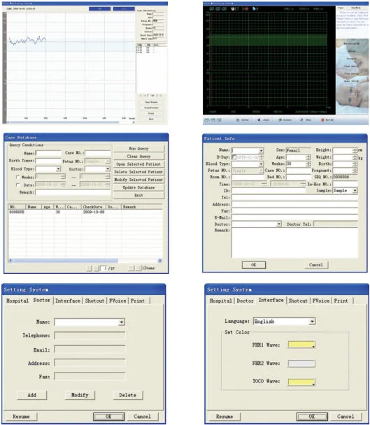 Sonotech Smart,Fetal doppler probe with USB connector,You may display everything through Sonotech Smart PC software.