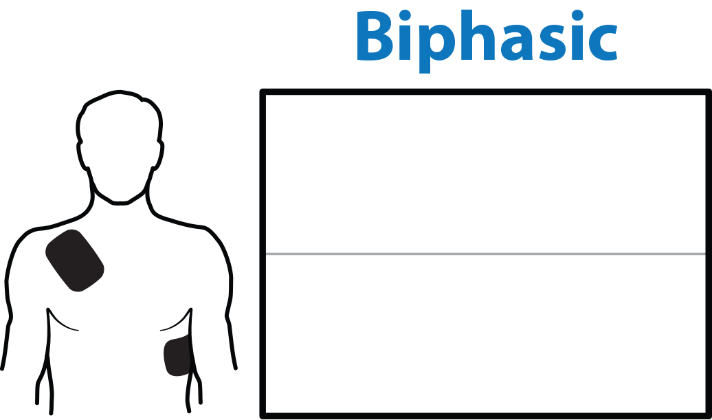 Animation à onde biphasique