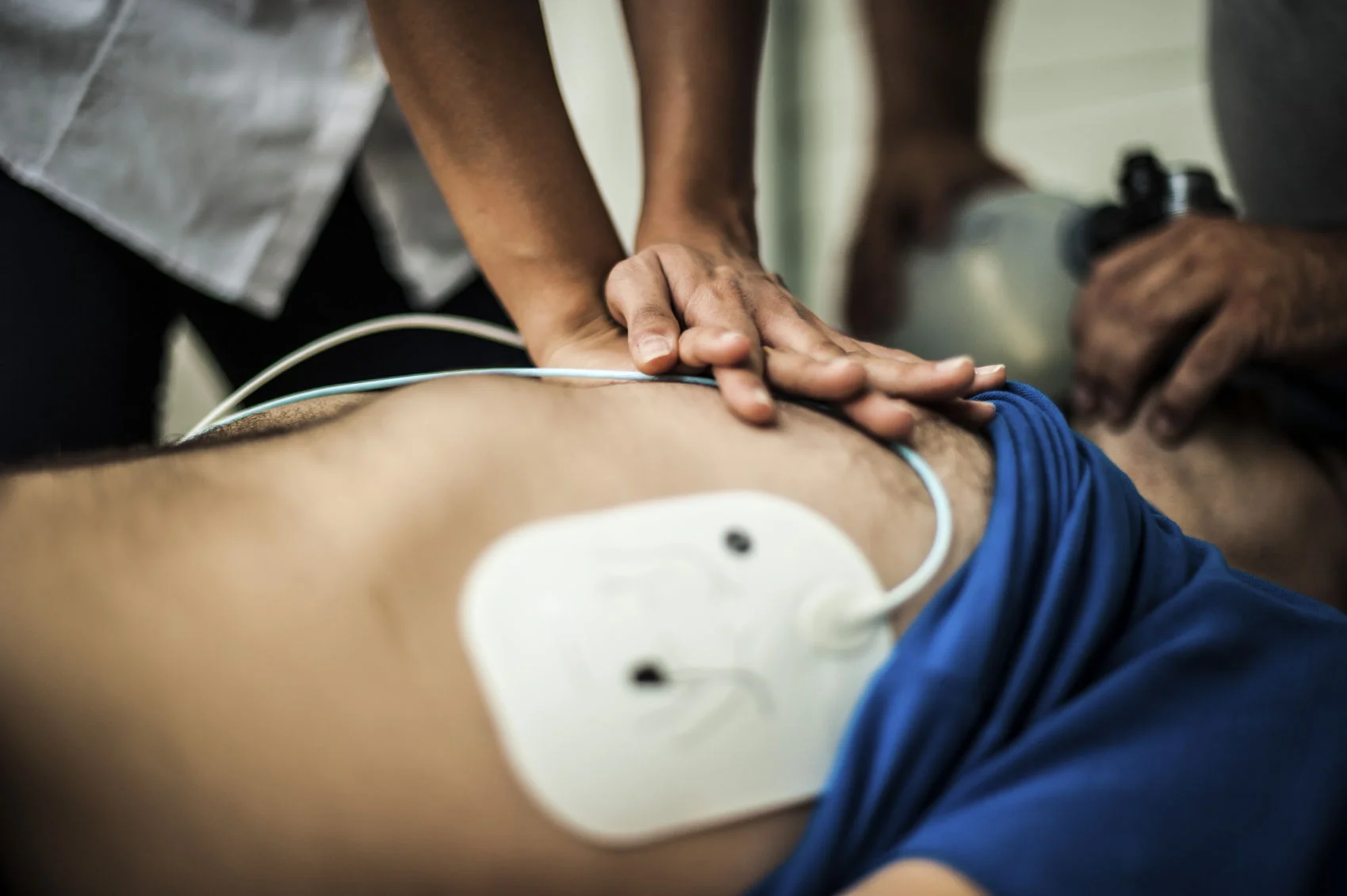 Ondes de défibrillation mono vs biphasique