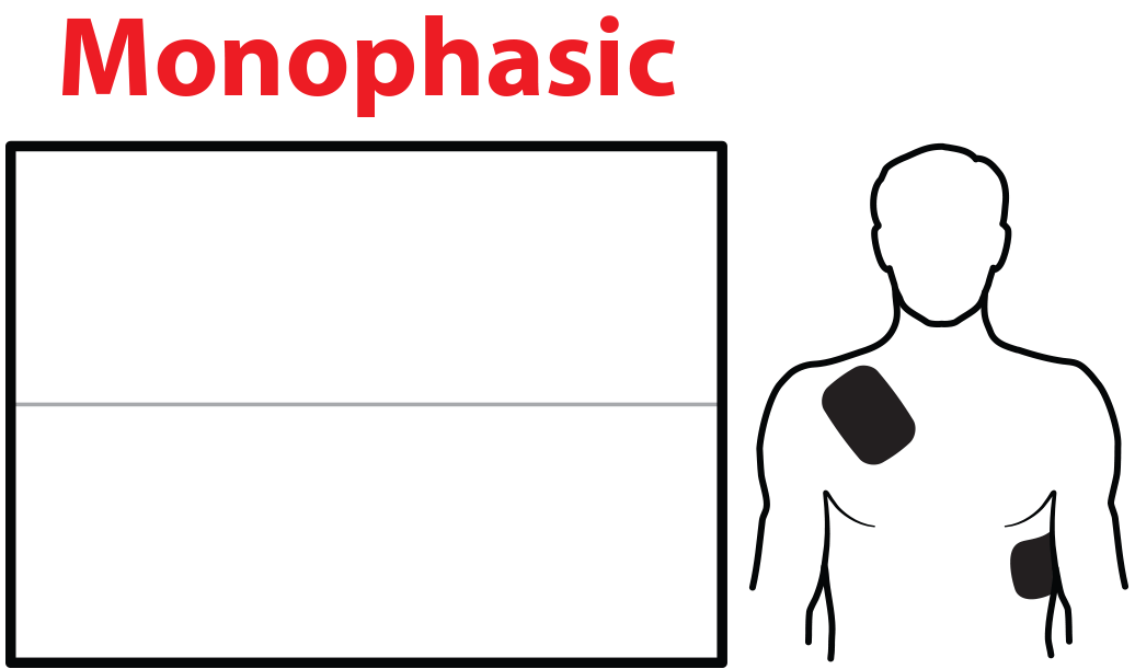 Animation de défibrillation monophasique